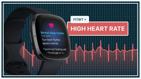 which fitbit has ecg